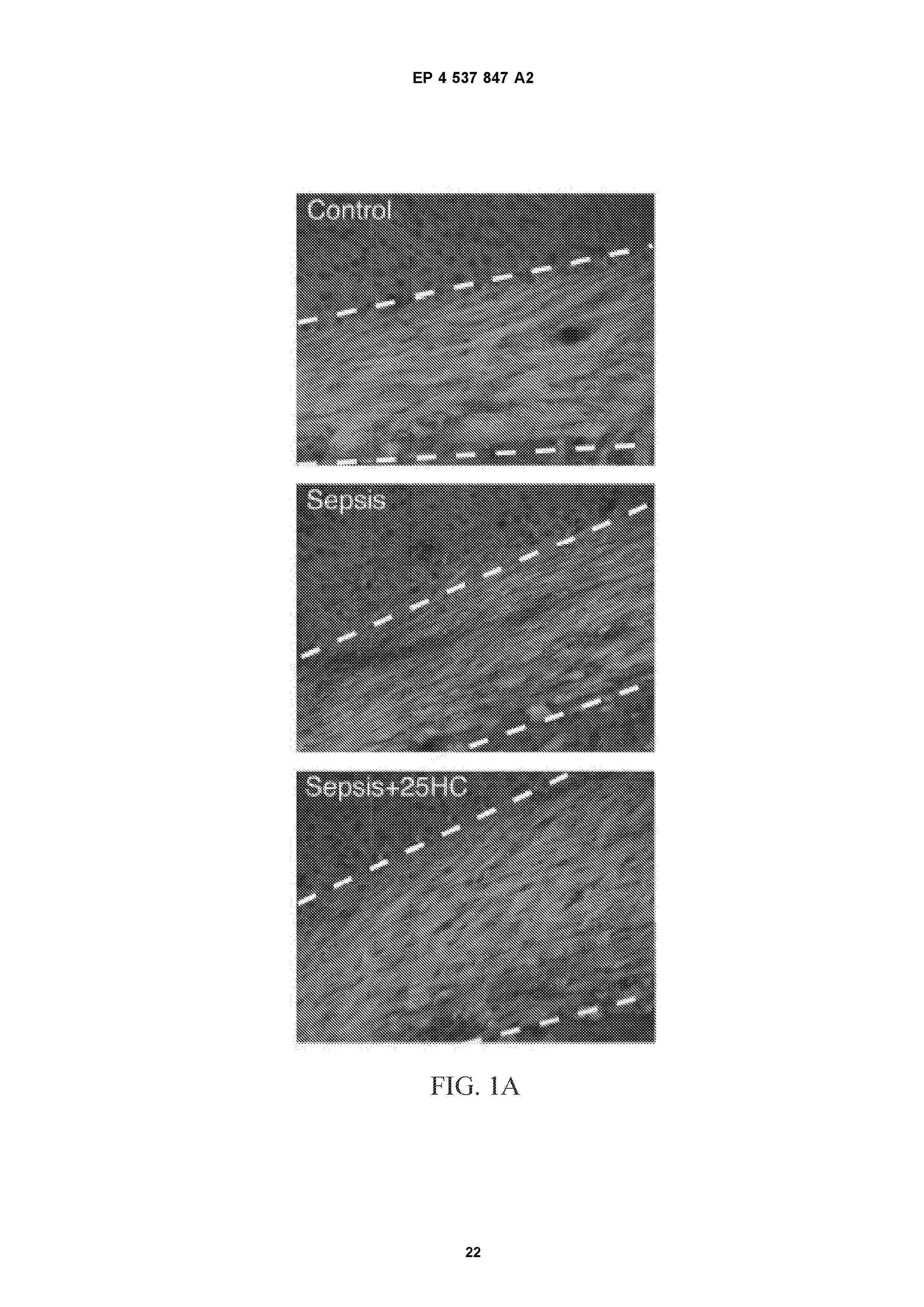 EP_4537847_A2