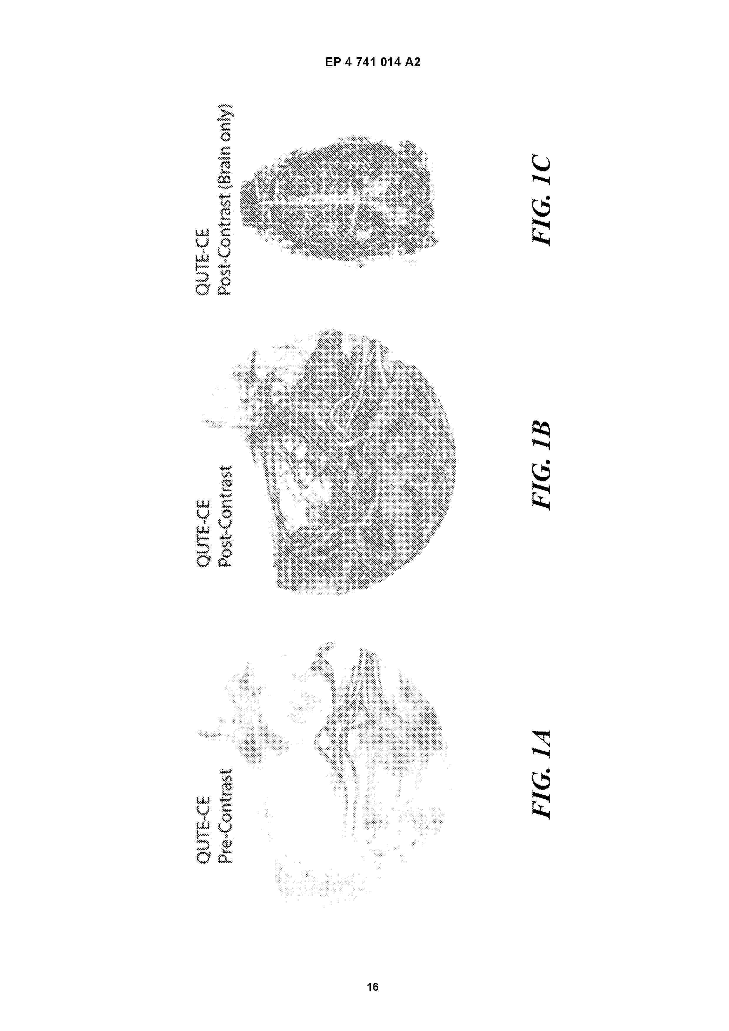 EP_4741014_A2
