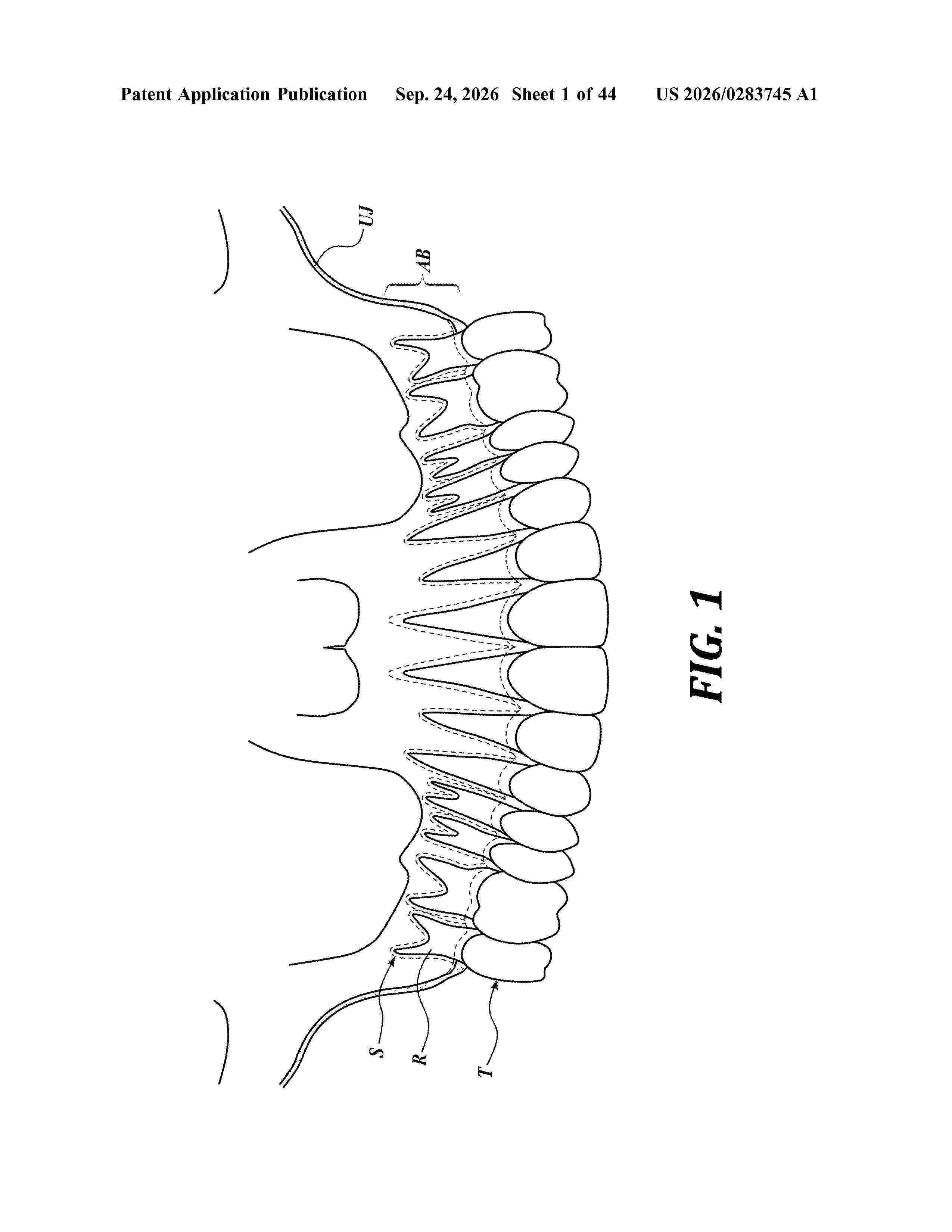 US_20260283745_A1