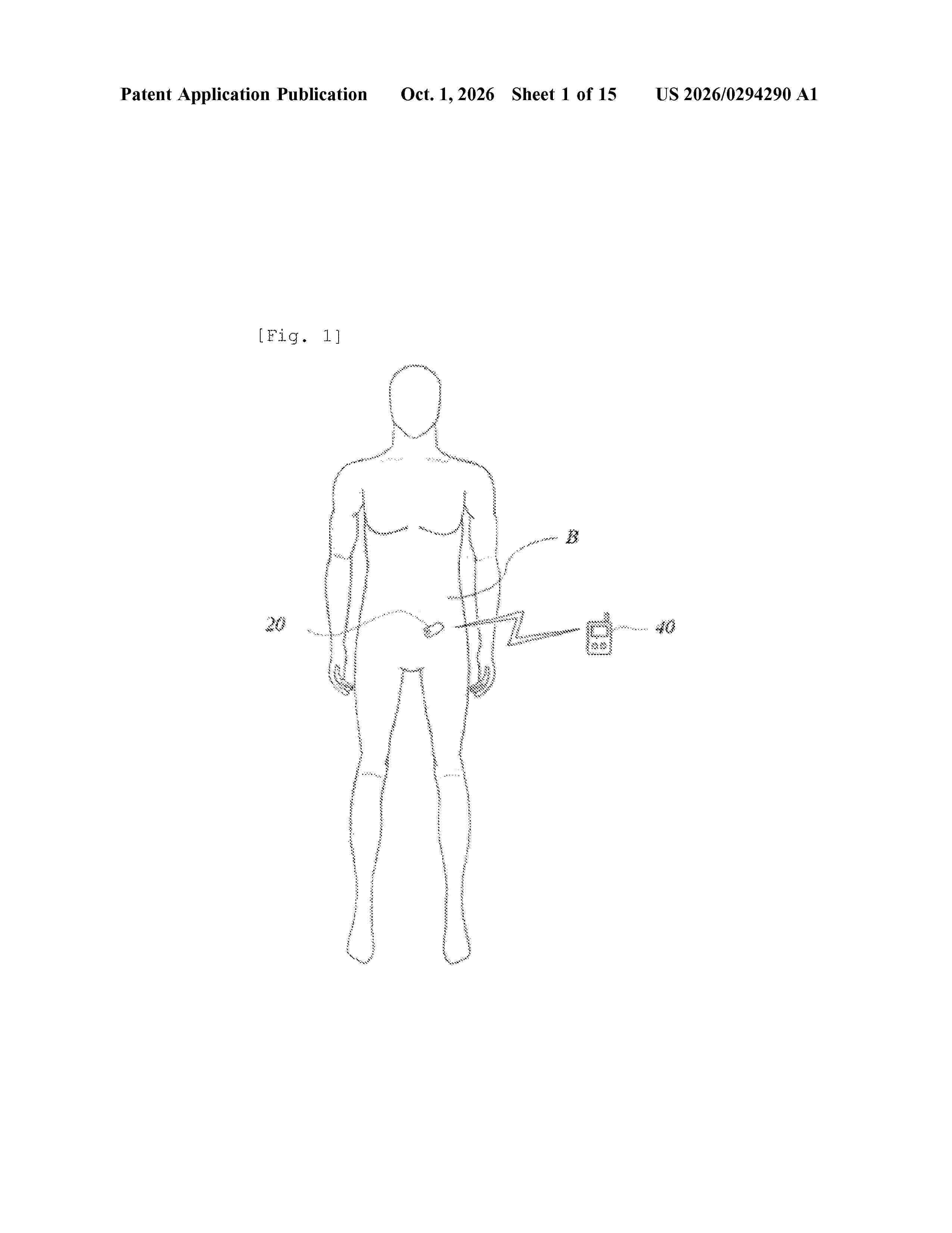US_20260294290_A1