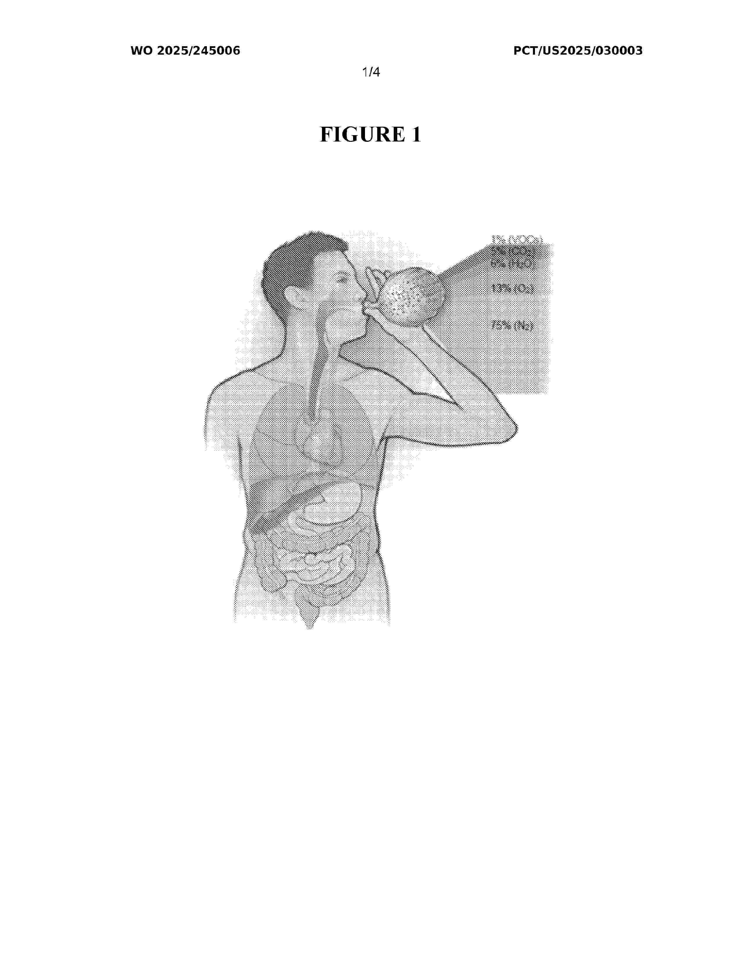 WO_2025245006_A1