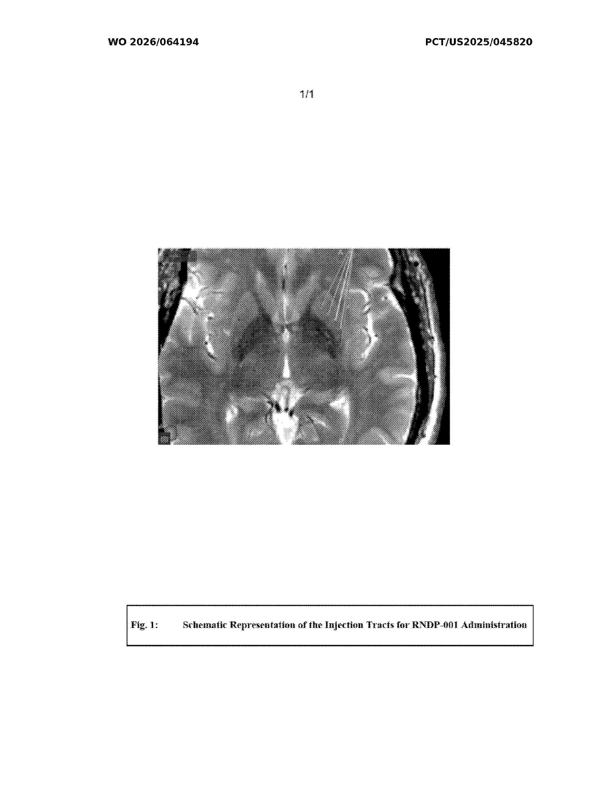 WO_2026064194_A1