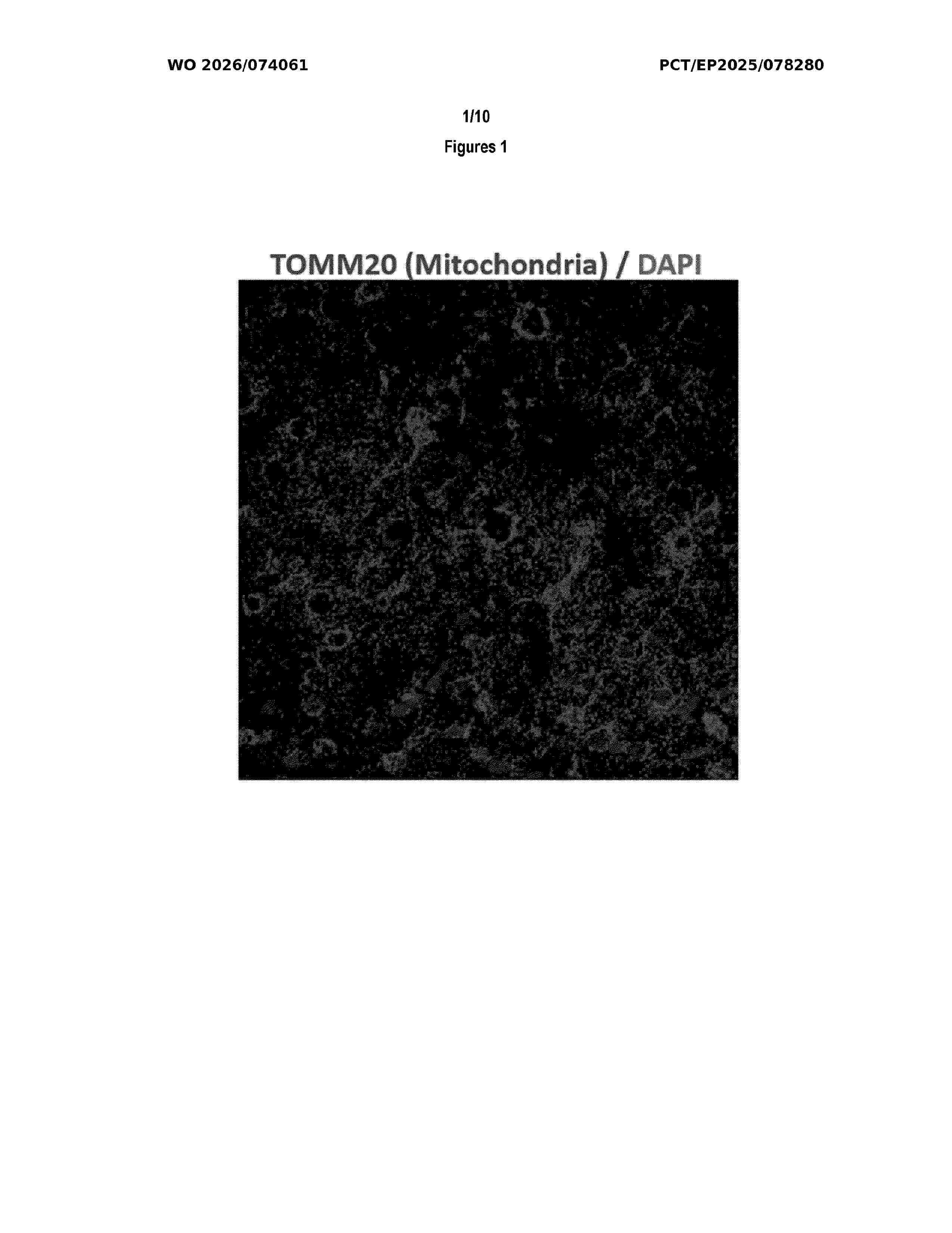 WO_2026074061_A1